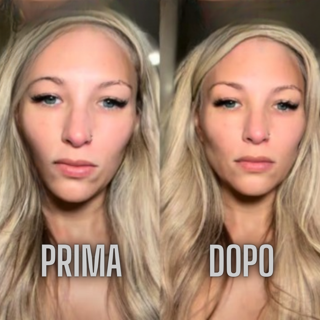 NightoLux™ Spazzola Massaggiante Viso - Drenaggio Linfatico - Effetto Glow - Pelle Luminosa in 3 Minuti